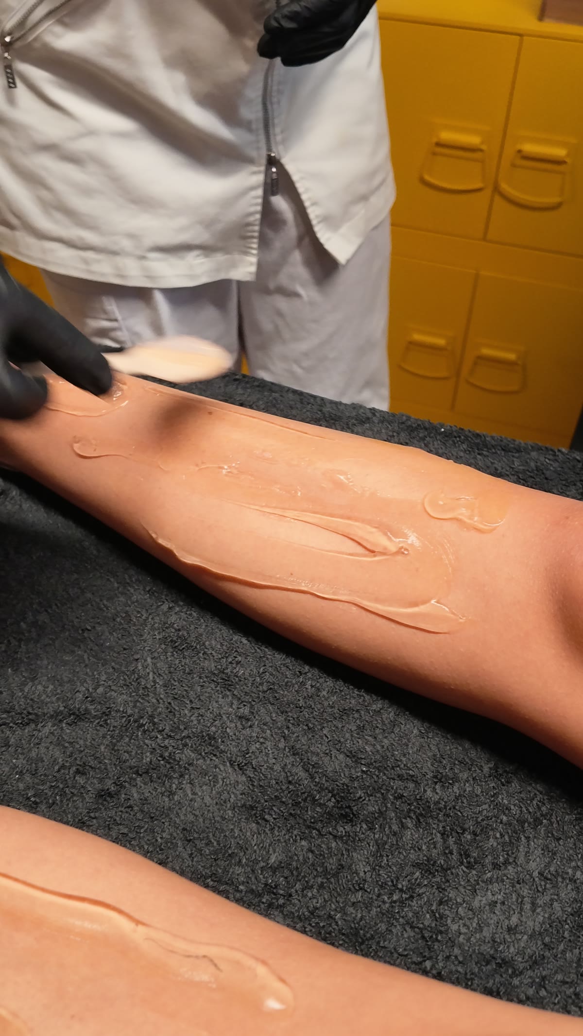 Kylande gel breds ut på benet innan laserbehandlingen hos Esperitu Estetik